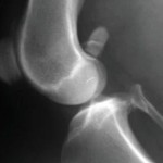 Diagnóstico radiológico de artrosis canina