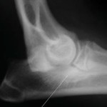 Diagnóstico radiológico de artrosis canina