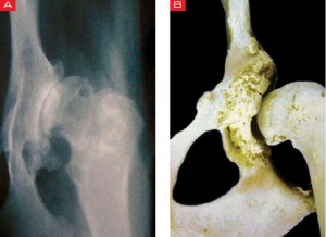 ¿Qué es la artrosis canina?