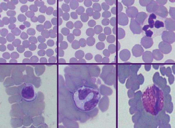 Estudio morfológico de las células sanguíneas